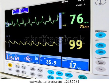 intensive care unit cardiac monitor