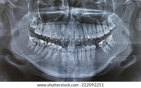 Jaw x-ray.