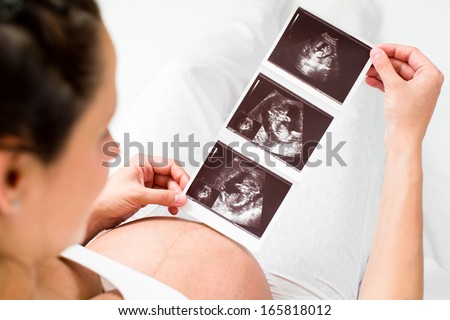 Pregnant Woman Reviewing Baby Ultrasound Scan