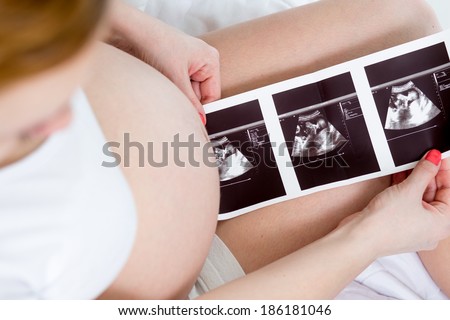 Pregnant woman reviewing baby ultrasound scan