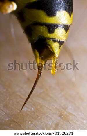 back of wasp in closeup while stinging a human
