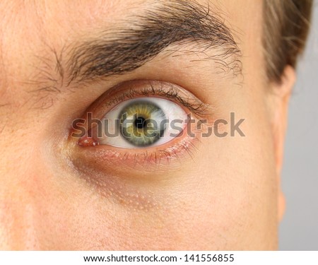 male eye, looking menacingly, raised eyebrow