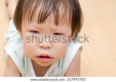 Asian girl with snot flowing from her nose