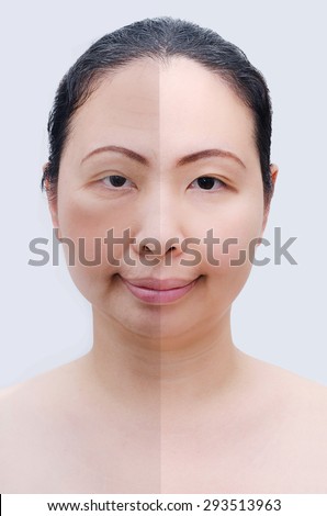 Portrait of asian woman before and after botox. Young and old face.