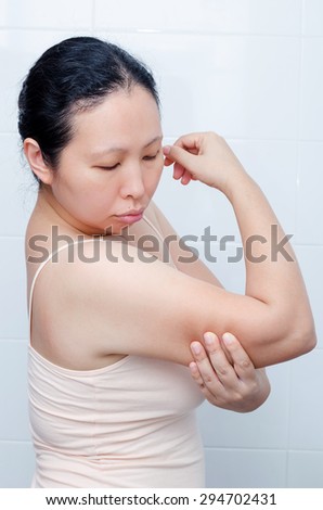 Asian woman looking at burned skin on her arm