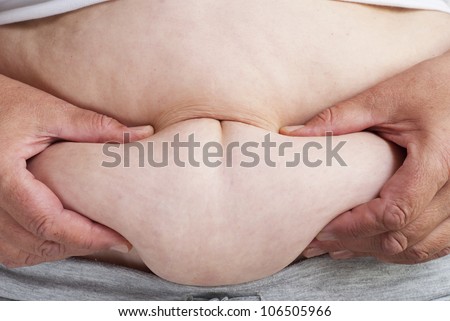 Fat female body part.
