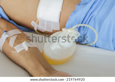 Surgeon patient with  fluid drain and IV needle in hospital