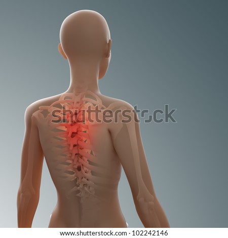Woman\'s health issues - back and spine injury
