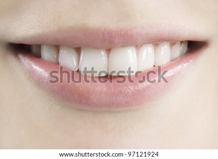 Close up view of a young, fresh, healthy smile.