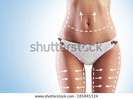 Female body with the drawing arrows. Fat lose, liposuction and cellulite removal concept.