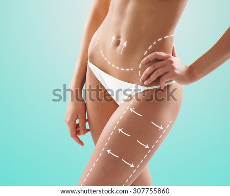 Female body with the drawing arrows on it isolated. Fat lose, liposuction and cellulite removal concept.