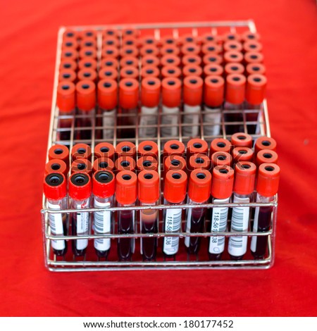 Tubes labeled with bar codes with blood samples
