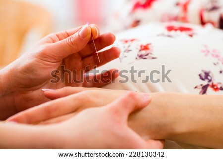 Midwife setting pregnant woman acupuncture needle