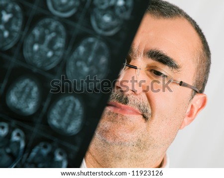 Medical Doctor looking at a tomography x-ray picture of skulls; focus on eyes