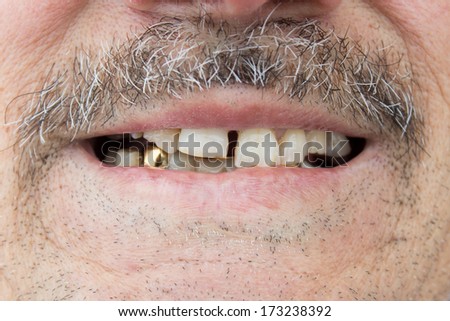 man showing his teeth, mouth and whiskers