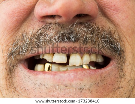 man showing his teeth, mouth and whiskers