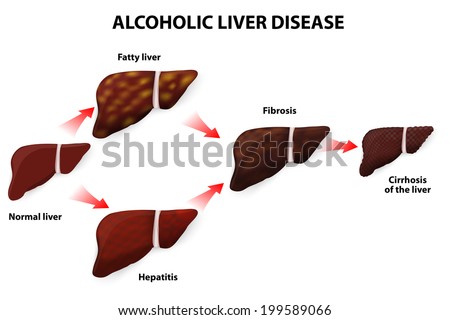 Can viagra cause liver problems