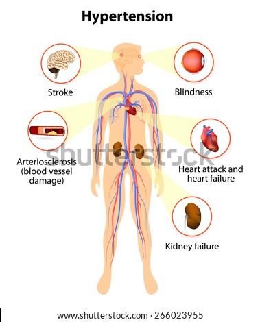 Research thesis on hypertension