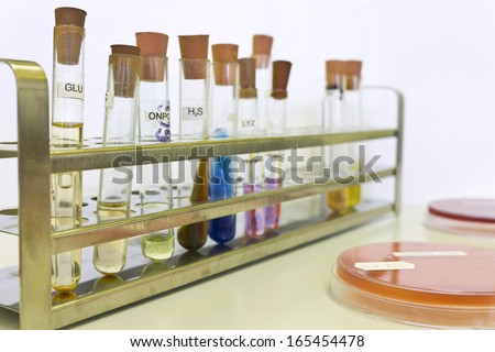 Microbiologic colorful test tubes and red blood agar plates used in microbiology research and diagnostic laboratories
