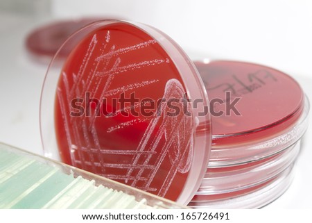 Detail of a tine white bacterial cultures on red blood agar in petri dishes against a white background