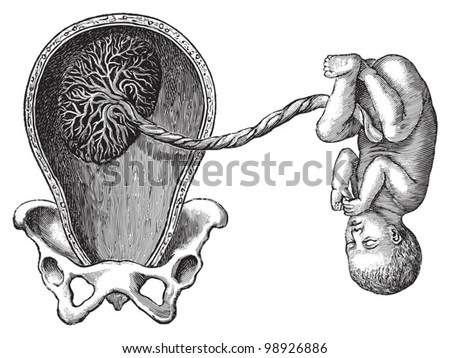 cartoon umbilical cord