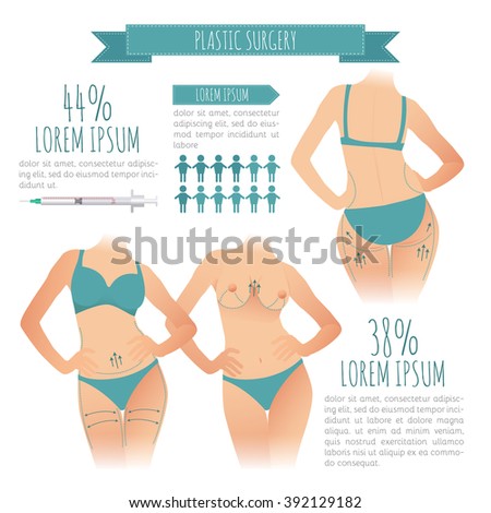 Plastic surgery infographic. vector illustrations of liposuction, breast augmentation, breast lift for your design