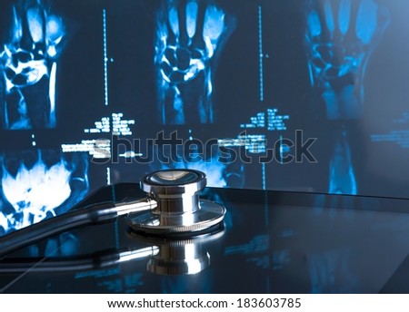 medical stethoscope on modern digital tablet pc in laboratory on x-ray images background. Concept of health care with new technology