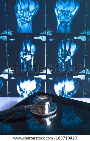 stethoscope on digital tablet pc in laboratory on x-ray images background. Concept of health care with new technology
