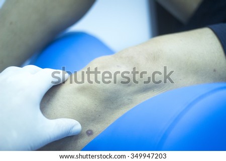 Patient leg in physical therapy physiotherapy clinic in medical center hospital rehabilitation room and hand of physiotherapist wearing sterile glove.