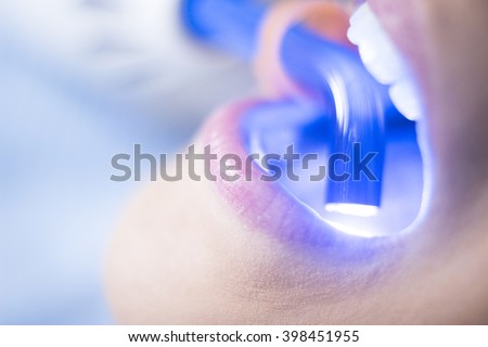 Dentist examining patient mouth in dental exam whitenening teeth with dentist\'s instrumentation in clinic.