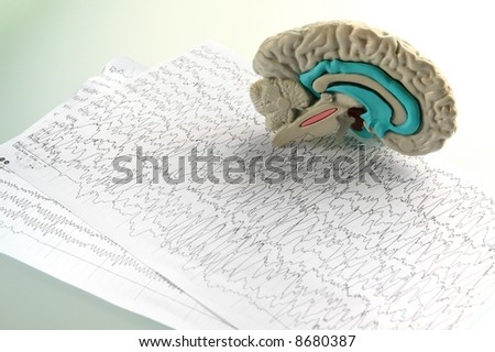 Mock-up of brain on diagram background and glass background