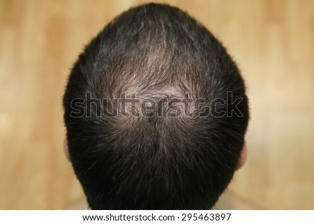 closeup background of bald head