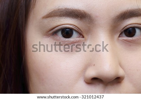 background of asian woman eye with wrinkle under eye bag