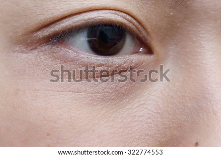 background of asian woman eye with wrinkle under eye bag