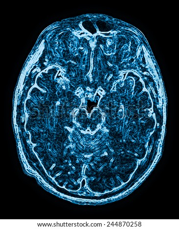 mri head magnetic resonance image of the head scan