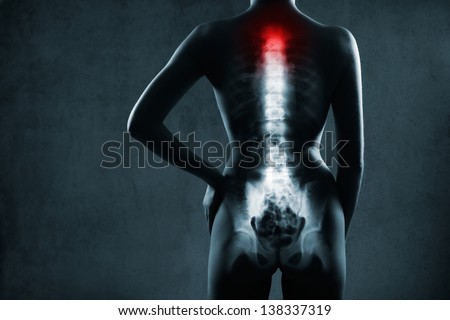 Human spine in x-ray, on gray background. The neck spine is highlighted by red colour.