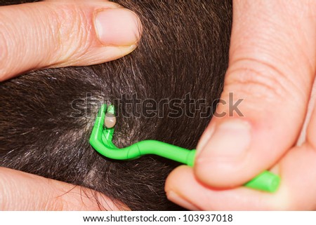 Closeup of a full tick in the fur of a dog with human hands holding green pliers to remove it