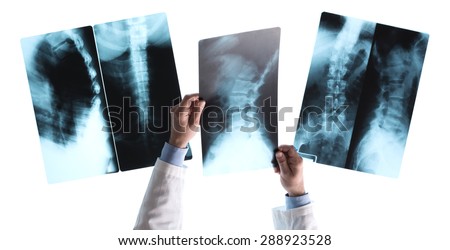 Radiologist checking an x-ray image on a view light box, unrecognizable person, medical assistance and healthcare concept
