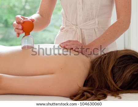 A young woman patient is being treated with cupping, an alternative medicine procedure