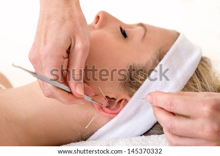 Alternative practitioner treating woman with acupuncture. Homeopath treating woman with ear acupuncture techniques, also known as auriculotherapy by using needles and pressure points