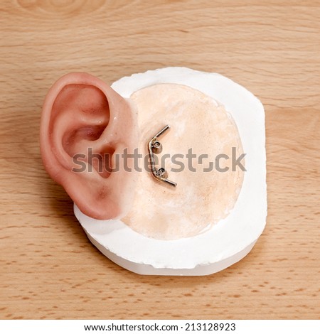 Metal Clip Closure Artificial Human Ear on Wooden Table. Clips located behind ear and anchored in bone
