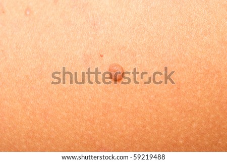 close up shot of human skin and mole