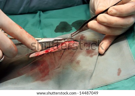 A surgeon using stitches to close a wound.