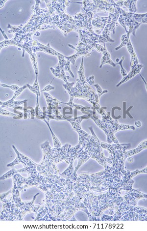 Microscope view of Prostate Cancer cells in tissue culture showing walls and nucleus.
