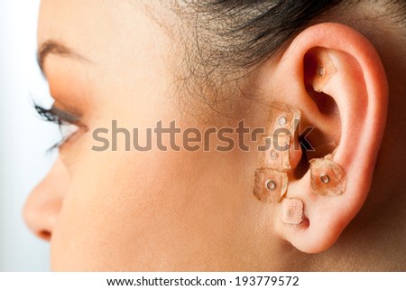 Macro close up of auriculotherapy on female ear.