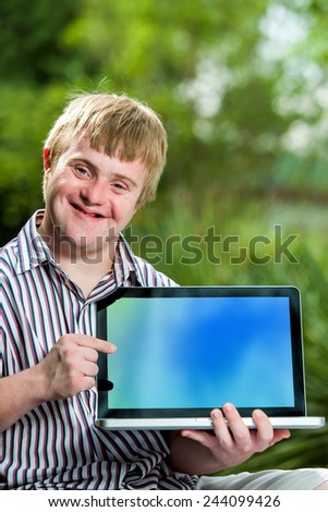 Close up portrait of handicapped student pointing at blank laptop screen against green outdoor background.