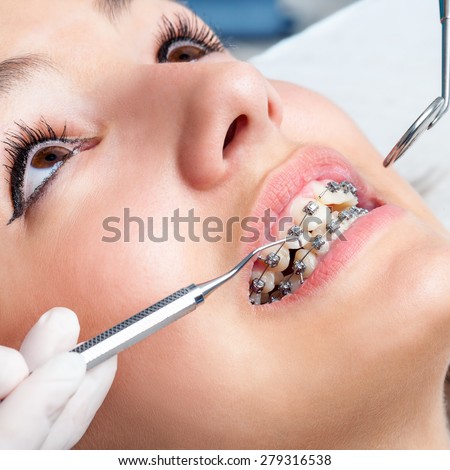 Extreme close up of hands working on dental braces with hatchet and mouth mirror. Macro close up of female mouth showing dental braces.
