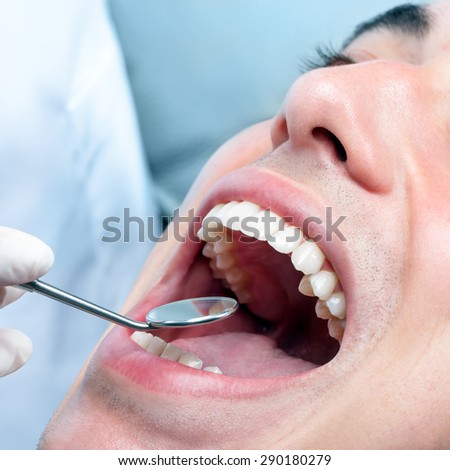 Macro close up of young man with open mouth showing healthy white teeth. Dentist hand checking teeth with mouth mirror.
