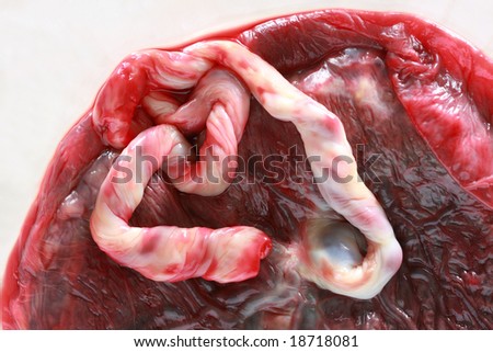 Close up of a fresh human placenta