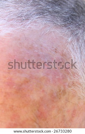 receding hairline of a senior man\'s grey head